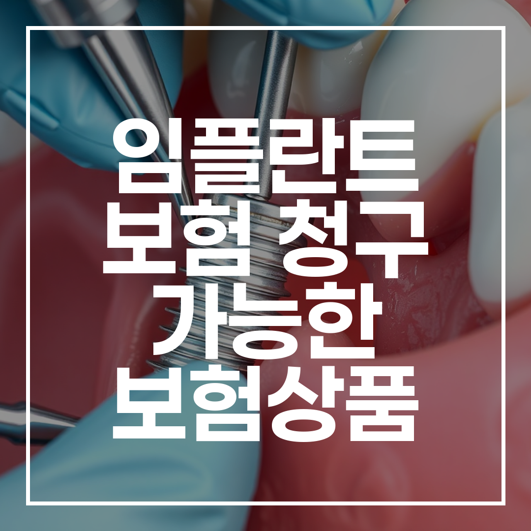임플란트 시술 중인 치아와 치과 도구의 고화질 실사 이미지